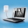 Intraoral Sensor New IDA